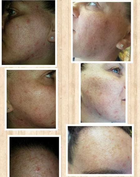 Simple Regeneration Age Resisting Facial Wash - Anti-Aging Cleanser with Prebiotics & Green Tea - 150ml