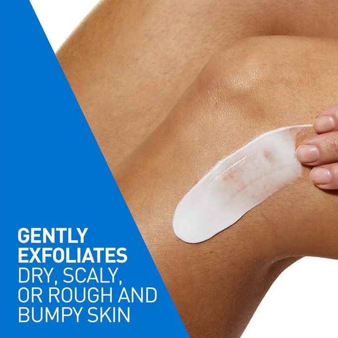 CeraVe SA Smoothing Cream 340g - Exfoliating Body Moisturizer for Rough & Bumpy Skin