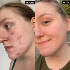 The Ordinary Glycolic Acid 7% Toning Solution