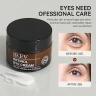 IREV Retinol Eye Cream 30g - Anti-Aging Eye Treatment for Dark Circles, Wrinkles & Puffiness