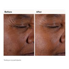 The Ordinary Glycolic Acid 7% Toning Solution