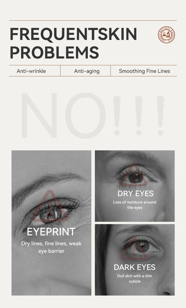 IREV Retinol Eye Cream 30g - Anti-Aging Eye Treatment for Dark Circles, Wrinkles & Puffiness