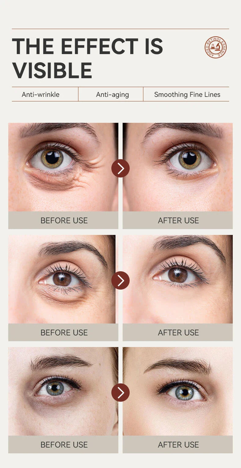 IREV Retinol Eye Cream 30g - Anti-Aging Eye Treatment for Dark Circles, Wrinkles & Puffiness