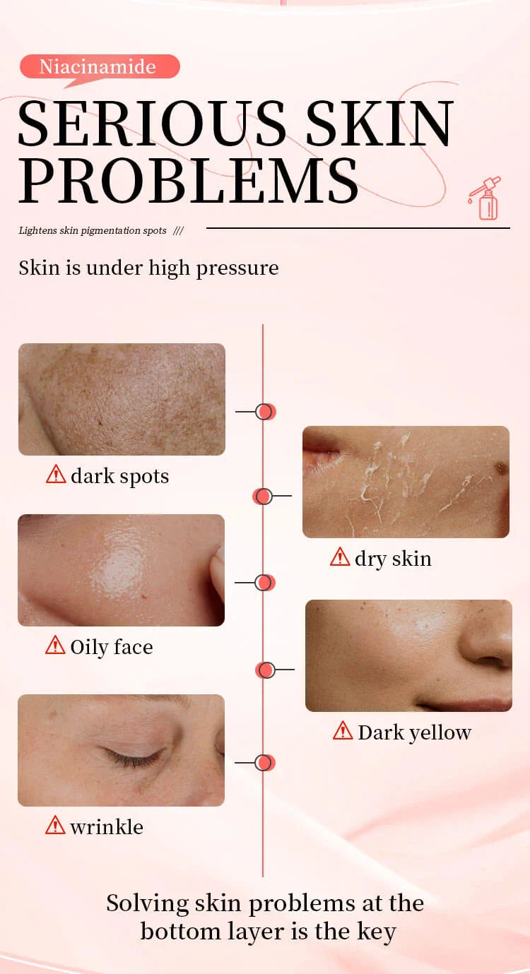 MOOYAM Niacinamide 10% + TXA 4% Dark Spot Correcting Serum - Brightening & Even Tone
